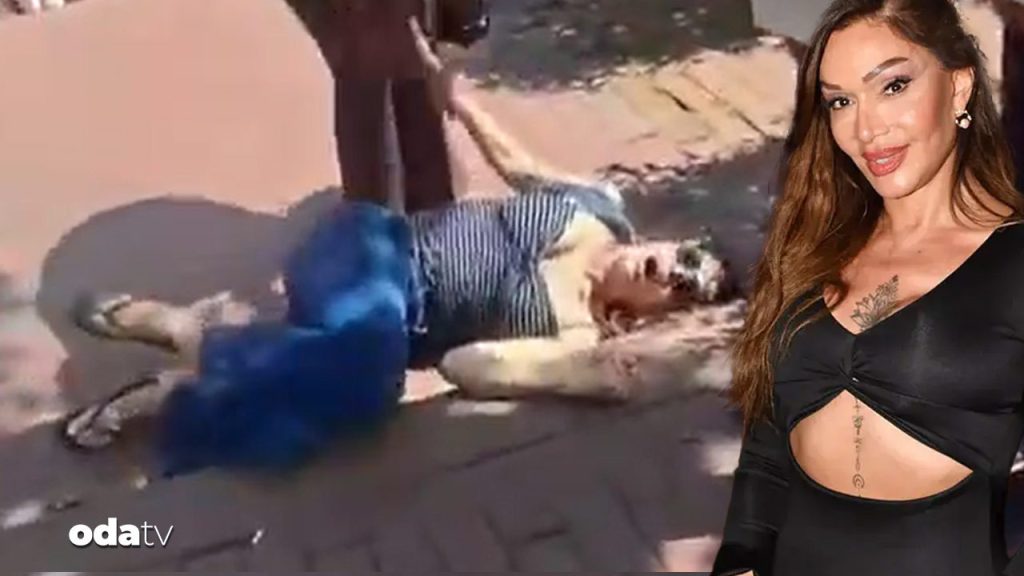 Sevda Demirel’in ayağı kırıldı